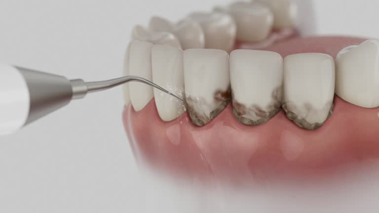Reliable Dental Implants contractor in Morrow, GA by Smile Center Dentistry